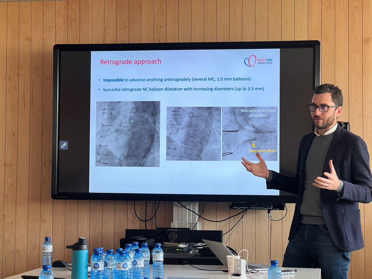 Héctor Cubero Gallego (@hcuberogallego) on Twitter photo Seguimos con el curso TACTICaL del <a href="/hospitaldelmar/">Hospital del Mar</a> Magnífico caso de ICP de CTO muy compleja del Dr. <a href="/JMonteroMD/">José Montero</a> <a href="/Euro4cSpain/">Euro4cSpain</a> <a href="/shci_sec/">ACI-SEC: Hemodinamica</a> <a href="/secardiologia/">Soc Esp Cardiología</a> #EAPCI #Euro4C #CTO #CHIP <a href="/beavaquerizo/">Beatriz</a> @helenatmCARDIO <a href="/rutalvar3z/">Rut Álvarez Velasco</a> <a href="/JorgPalazuelos/">Jorge Palazuelos</a> <a href="/josepgomezlara/">josep</a> Seguimos con el curso TACTICaL del <a href="/hospitaldelmar/">Hospital del Mar</a> Magnífico caso de ICP de CTO muy compleja del Dr. <a href="/JMonteroMD/">José Montero</a> <a href="/Euro4cSpain/">Euro4cSpain</a> <a href="/shci_sec/">ACI-SEC: Hemodinamica</a> <a href="/secardiologia/">Soc Esp Cardiología</a> #EAPCI #Euro4C #CTO #CHIP <a href="/beavaquerizo/">Beatriz</a> @helenatmCARDIO <a href="/rutalvar3z/">Rut Álvarez Velasco</a> <a href="/JorgPalazuelos/">Jorge Palazuelos</a> <a href="/josepgomezlara/">josep</a>