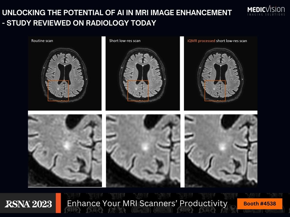 Medic Vision Imaging Solutions tweet media