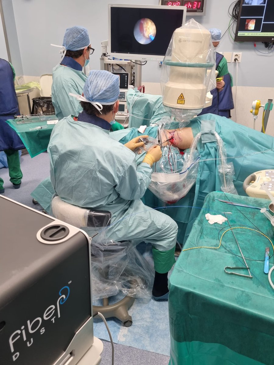 Day 2️⃣ at @EndourologyT 🔥 
#Livesurgery by Dr. @GoumasUrologia and Dr. Michele Raguso with #FiberDust #miniECIRS 
#TNT2023 #BeQuanta