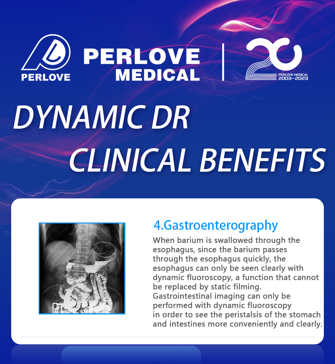 PerloveMedical's tweet photo. Unlocking Clinical Precision: 𝐭𝐡𝐞 𝐂𝐥𝐢𝐧𝐢𝐜𝐚𝐥 𝐁𝐞𝐧𝐢𝐟𝐢𝐭𝐬 𝐨𝐟 𝐃𝐲𝐧𝐚𝐦𝐢𝐜 𝐃𝐑
4️⃣ ：#Gastrointestinal #fluoroscopy, a cornerstone of DR's #clinical prowess, illuminates the intricate dynamics of the digestive system with unprecedented clarity.

#DynamicDR https://t.co/66oFl0tK0A