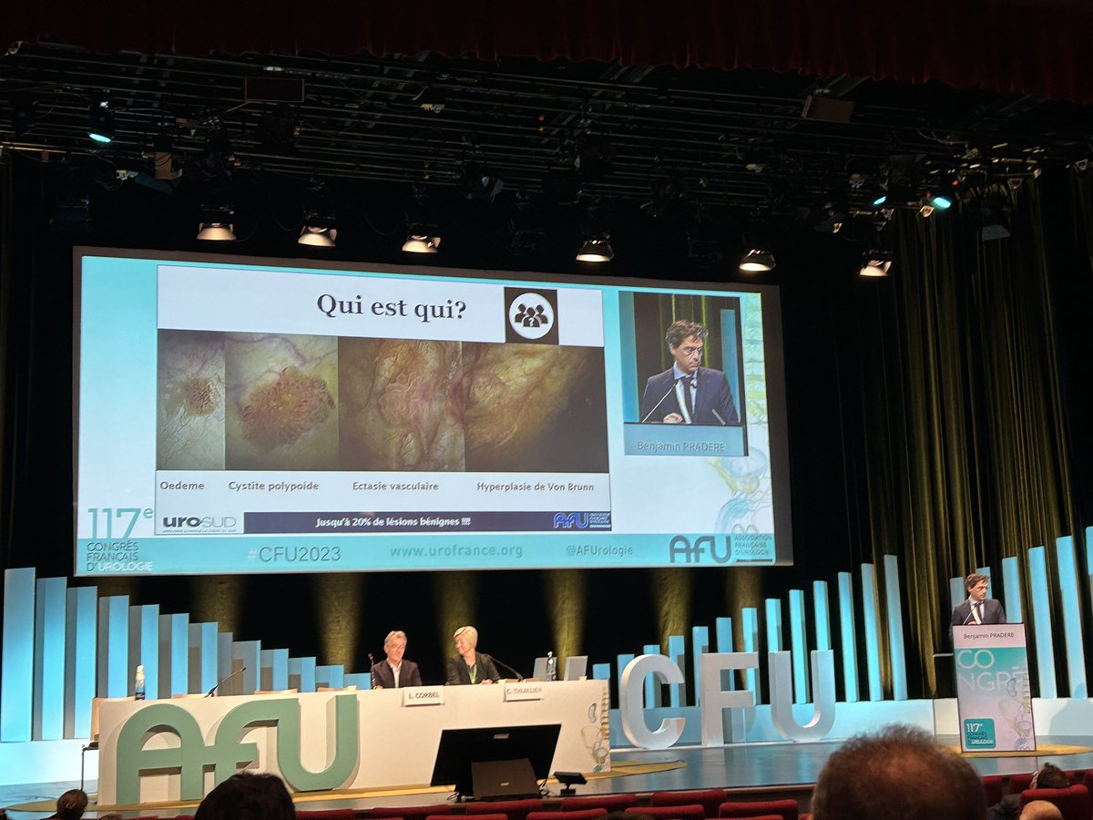 BPeyronnet's tweet photo. Incredible plea for active surveillance in low grade #nmibc by @BenjaminPradere 100% convinced &amp; ready to include it in my practice as per @AFUrologie guidelines. Proud to say that my best man🤵‍♂️is also the best speaker of #cfu2023!! https://t.co/4ITpQkv9Dg
