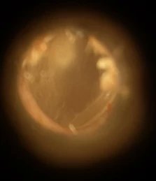 TMHCLtd's tweet photo. Do you have a problem with Ear Wax build up? We provide both Microsuction and Irrigation methods of removal.
Visit https://t.co/2ok5TOltzo to see our short videos on both procedures. 
#earwax #earwaxremoval https://t.co/ahSOaW6jrt