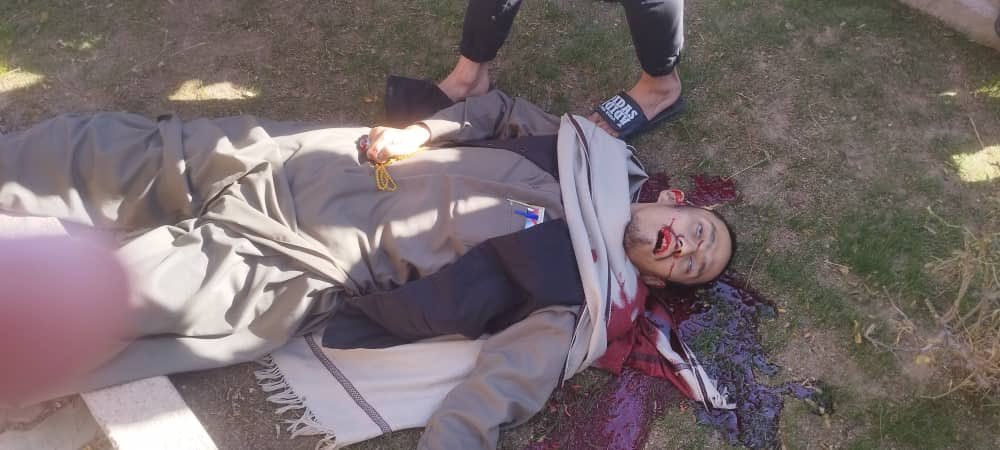 7_brbrbr's tweet photo. 🔸#Afghanistan: Two Hazara/Shia scholars were gunned down by unidentified assailants in Jibril town, Herat province today. The #ISKP/#ISIS group is the prime suspect in this deliberate attack. #SecurityEvent #ISIS  #Herat https://t.co/5M29fQVOPM