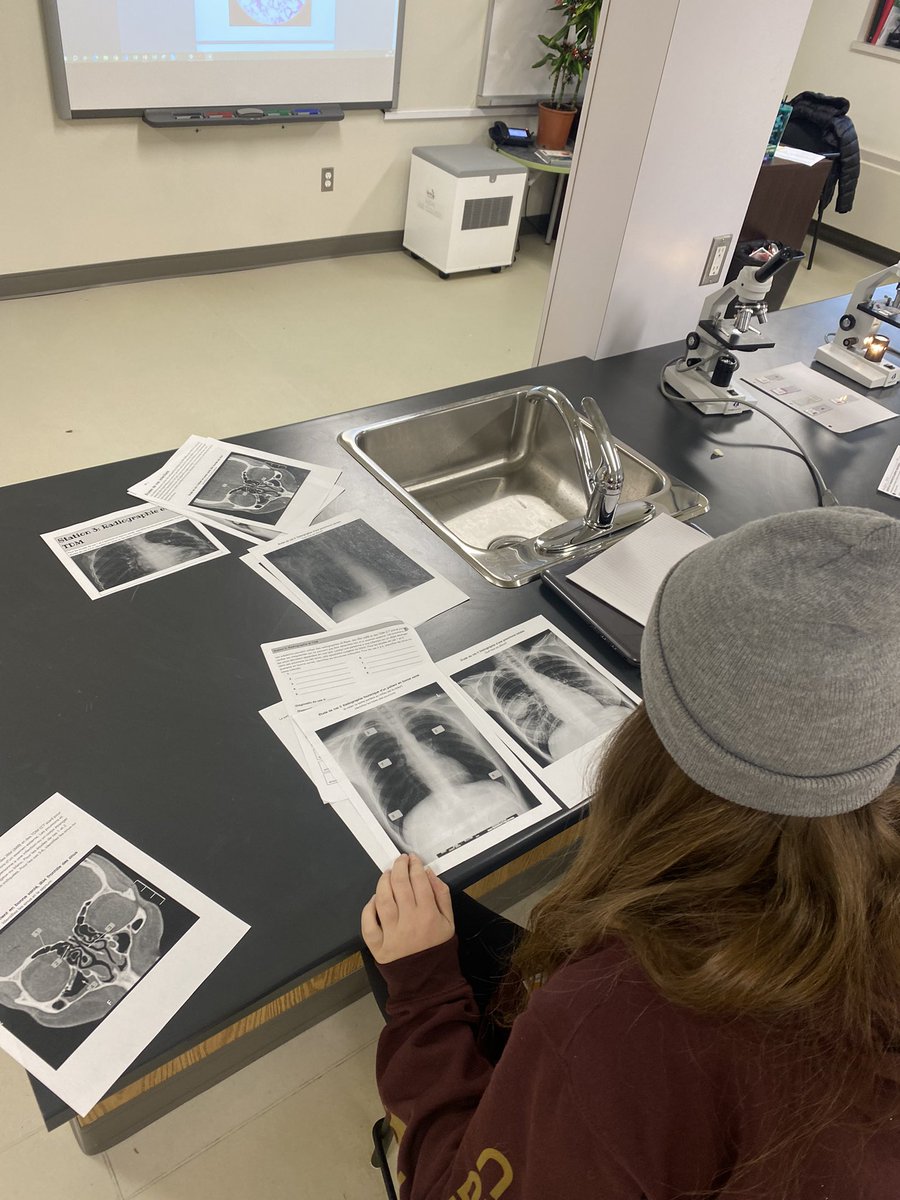 EmWilliams5's tweet photo. Exploration de l’anatomie et de la physiologie du système respiratoire aujourd’hui avec les élèves de #SBI3U!  @acnotredame https://t.co/IGtw0tBu6m