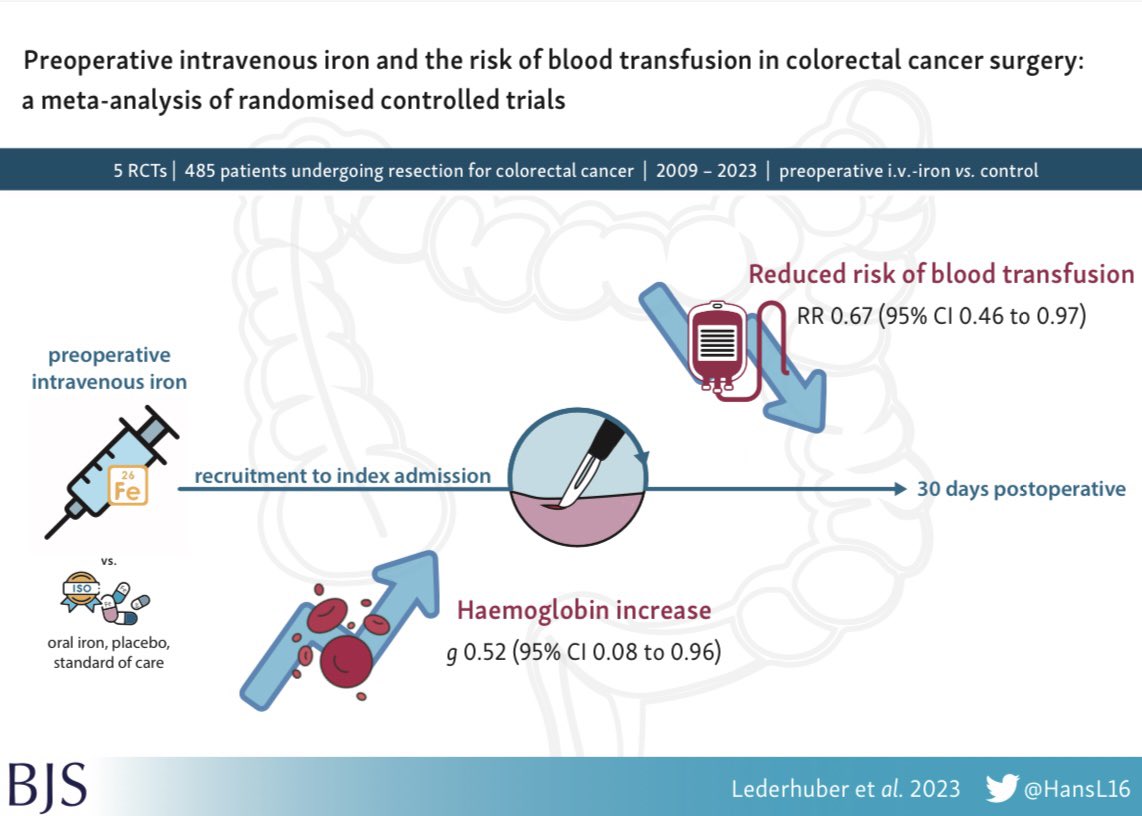 Hans Lederhuber (@hansl16) on Twitter photo Preoperative intravenous 💉iron in colorectal cancer 🦀 reduces risk of perioperative blood transfusion🩸
academic.oup.com/bjs/article-lo…
😃 to have this published in <a href="/BJSurgery/">BJS</a> with <a href="/lisahmassey/">Lisa Massey</a> <a href="/Neil_J_Smart/">Neil Smart</a> <a href="/Mcfark/">Frank McDermott</a> <a href="/AbeysiriDr/">Dr S Abey</a> @TobyRichardsUCL <a href="/N_Raj_/">Niroshini Rajaretnam</a> <a href="/LachieMiles/">Lachlan Miles</a> & Marius Roman Preoperative intravenous 💉iron in colorectal cancer 🦀 reduces risk of perioperative blood transfusion🩸
academic.oup.com/bjs/article-lo…
😃 to have this published in <a href="/BJSurgery/">BJS</a> with <a href="/lisahmassey/">Lisa Massey</a> <a href="/Neil_J_Smart/">Neil Smart</a> <a href="/Mcfark/">Frank McDermott</a> <a href="/AbeysiriDr/">Dr S Abey</a> @TobyRichardsUCL <a href="/N_Raj_/">Niroshini Rajaretnam</a> <a href="/LachieMiles/">Lachlan Miles</a> & Marius Roman