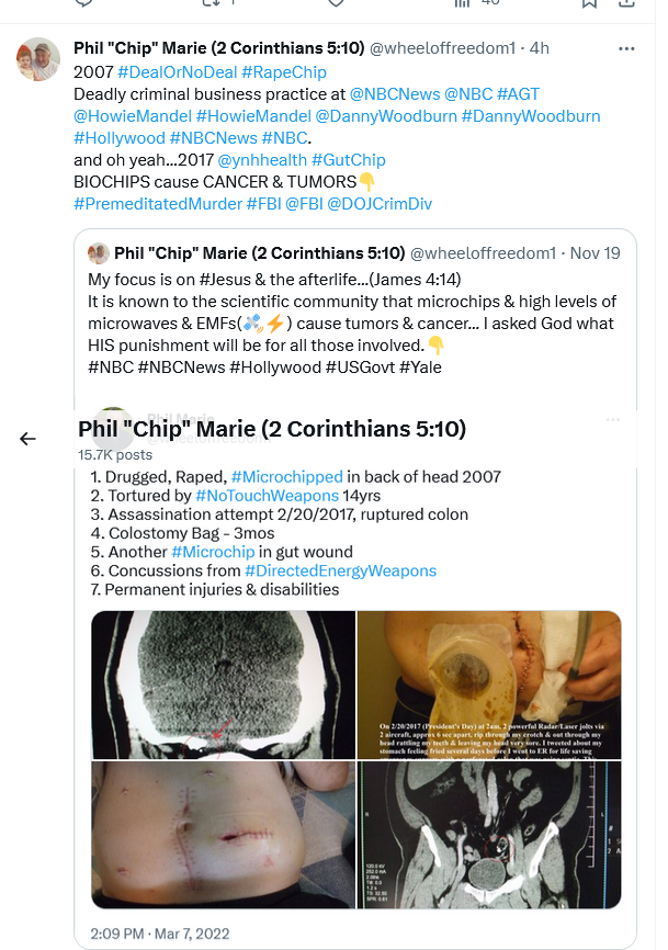 wheeloffreedom1's tweet photo. @NBCNews Who will take responsibility if these biochips in my body have caused cancer &amp; tumors? 
Does the "likeness" clause of a game show cont/app give #NBC the right to date-rape drug me, anal-rape me &amp; chip me in 2007? 
Do you think you own my body to torture me w/ 🛰️⚡️shocks? @FBI https://t.co/oVjGOXC7UG