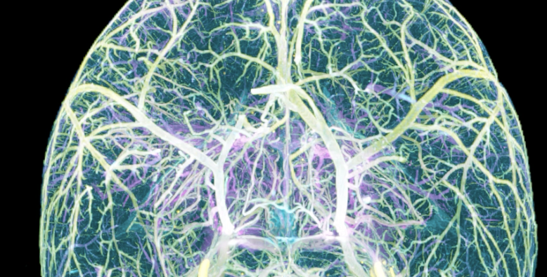 Nicolas Renier (@nicolasrenier) on Twitter photo I am very grateful to my lab, to the ERC consolidator panel, to the external reviewers for getting a #ERCCoG award to study neurovascular plasticity during pregnancy. 🥳Thank you <a href="/ERC_Research/">European Research Council (ERC)</a> for supporting us for another round! I am very grateful to my lab, to the ERC consolidator panel, to the external reviewers for getting a #ERCCoG award to study neurovascular plasticity during pregnancy. 🥳Thank you <a href="/ERC_Research/">European Research Council (ERC)</a> for supporting us for another round!