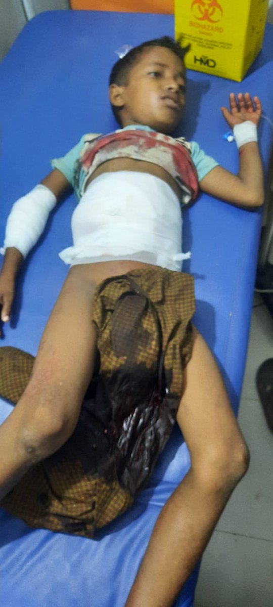 RFR63166391's tweet photo. An 8-year-old young was shot dead, four Rohingya men were inhumanely beaten and 3 were arrested by #RSO terrorists in Camp-4, Kutupalong today. It's learned that the terrorist group #RSO came to find the young boy's father, when he run out from the tent, the child was targeted. https://t.co/13zNfyiAqz