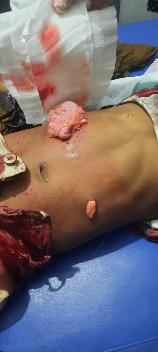RFR63166391's tweet photo. An 8-year-old young was shot dead, four Rohingya men were inhumanely beaten and 3 were arrested by #RSO terrorists in Camp-4, Kutupalong today. It's learned that the terrorist group #RSO came to find the young boy's father, when he run out from the tent, the child was targeted. https://t.co/13zNfyiAqz