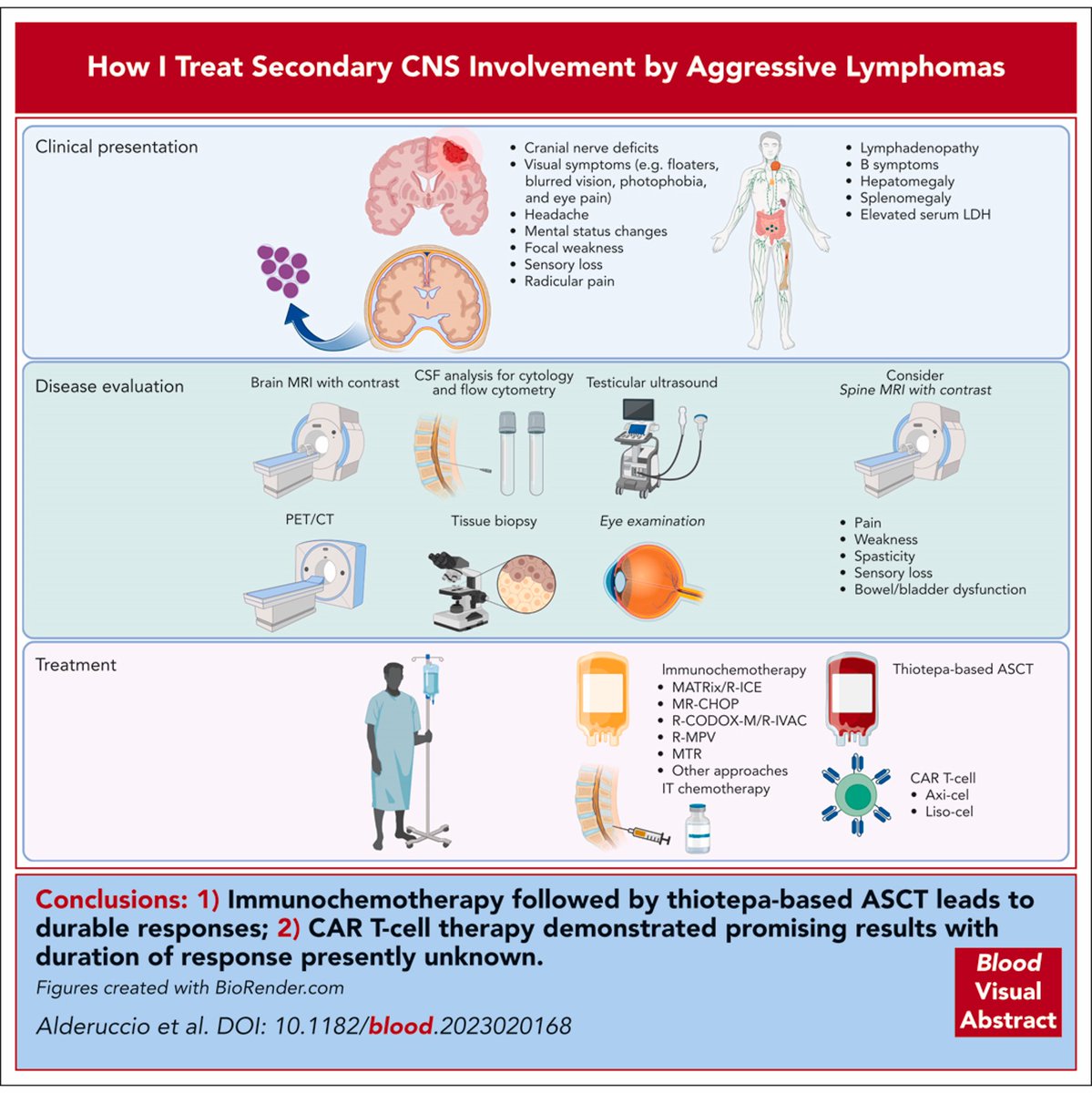 Published in @BloodJournal today, our approach to secondary CNS involvement by aggressive lymphomas Here is a free access link authors.elsevier.com/a/1i8Pv1UYwjRKH ashpublications.org/blood/article-…