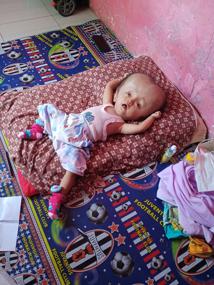 makeitups's tweet photo. “DO YOUR MAGIC”

Kasian banget De Naila. Sempet dioperasi tapi gagal, cairannya makin menggumpal di otak. Ayahnya cuman tukang servis handphone, lagi banting tulang, berharap anaknya ini masih bisa sembuh.

a thread https://t.co/qk70G7RQ1L