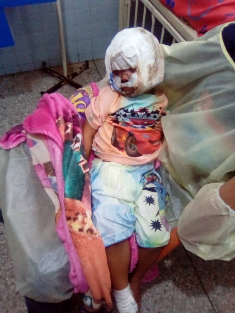 LuisReyes_30's tweet photo. #URGENTE Este es el estado actual del niño Ángel Zambrano. Sigue hospitalizado en el Hospital Dr Miguel Oraa de #Guanare. Sus padres no la han tenido fácil pero sí han recibido apoyo. Salvemos este angelito. Sigamos difundiendo 🙏
@MamaLisVzla @AlexaGomezDos
#Ayuda
#Farmatodo https://t.co/HdRcHnBosm