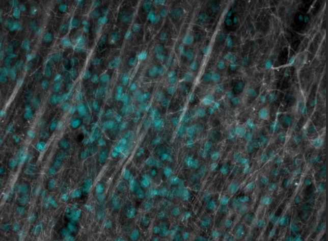 NeuroAlc's tweet photo. Las fotografías de las investigadoras del @NeuroAlc  @RaquelGarciaHz  (@CanalsLab) y Chiara Nappi (Lab. F. Taberner) han sido seleccionadas para la exposición del evento divulgativo #CienciaContigo2023 que el @CBMSO_CSIC_UAM  celebrará este sábado con motivo del Año Cajal 👏👏 https://t.co/TwrFVWHOCa