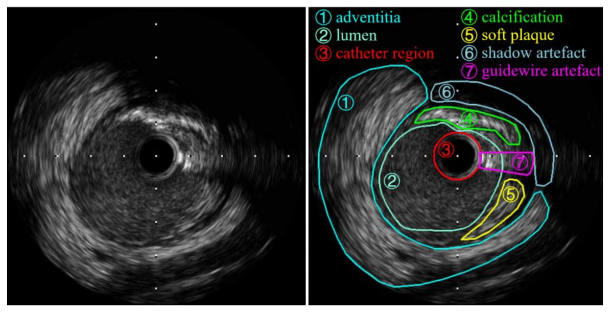Isaac Tea tweet media
