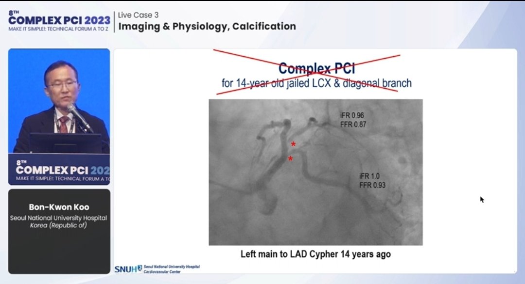 #COMPLEXPCI2023 💥Physiological assessment can help in: ✔ Guiding stenting strategy for LM/Bifurcation PCI ✔ Safe Deferral of Stenting in apparently severe disease on angio assessment @summitmd_cvrf #cardioTwitter