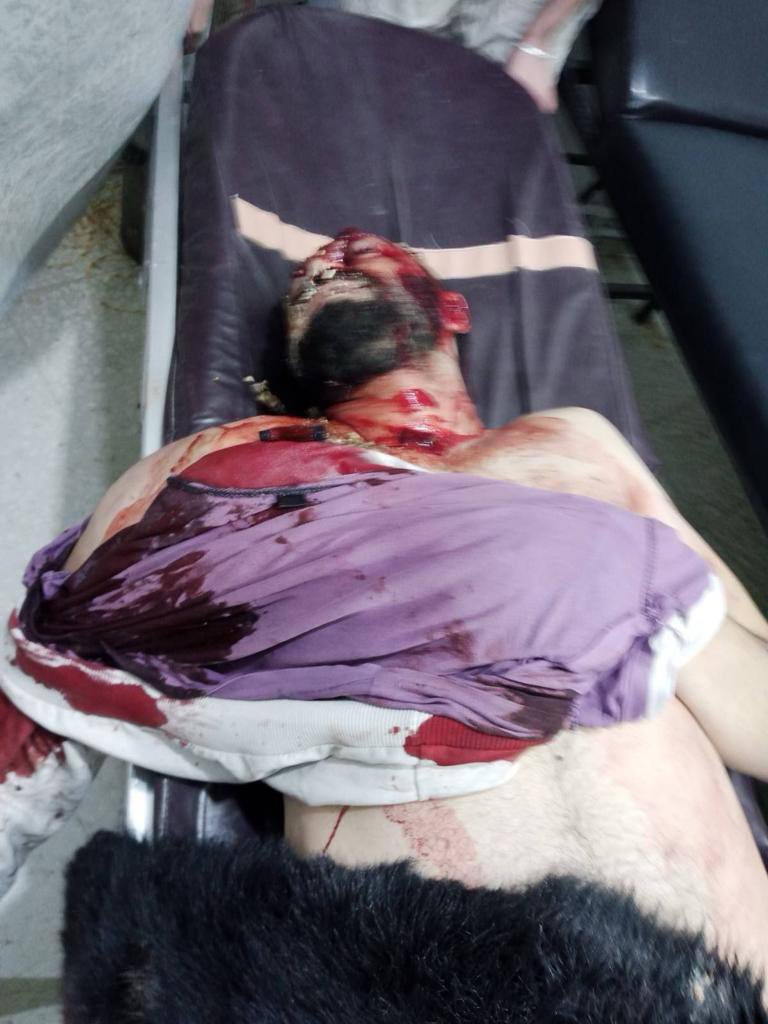 aminahekmet's tweet photo. Esto no ha pasado en #Gaza, esto es #Rojava.

Anoche, estas tres personas de una sola familia resultan heridas en un ataque de un dron turco contra su coche.

Erdogan pide la protección de civiles en Gaza, mientras comete crímenes aquí en #rojava https://t.co/jp5JpWuaoo