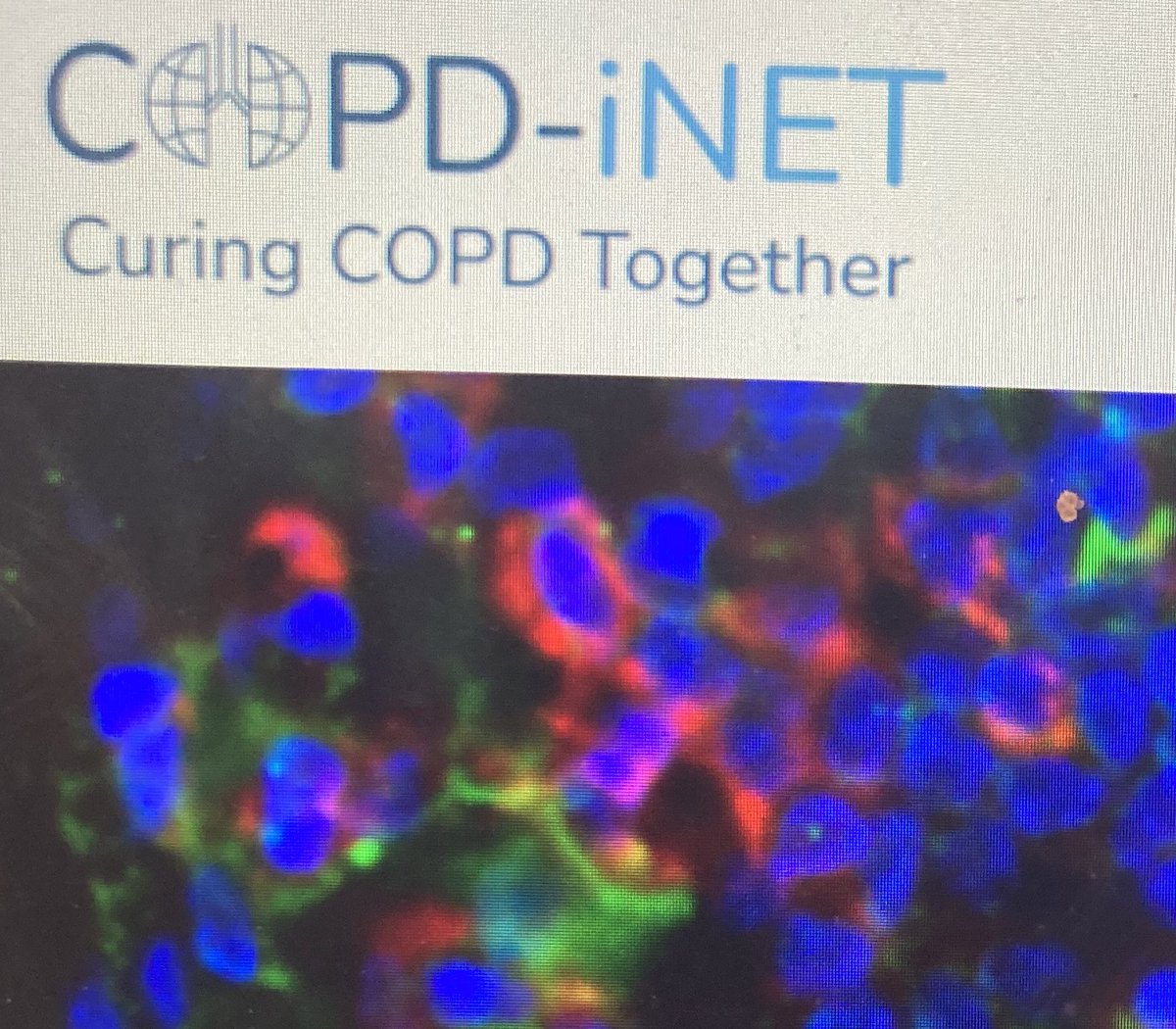 Did you miss our first #COPDiNET2023 symposium? Read here what we discussed and how we are planning to #cureCOPD. #TogetherWeAreBetter

copd-inet.com/symposium/