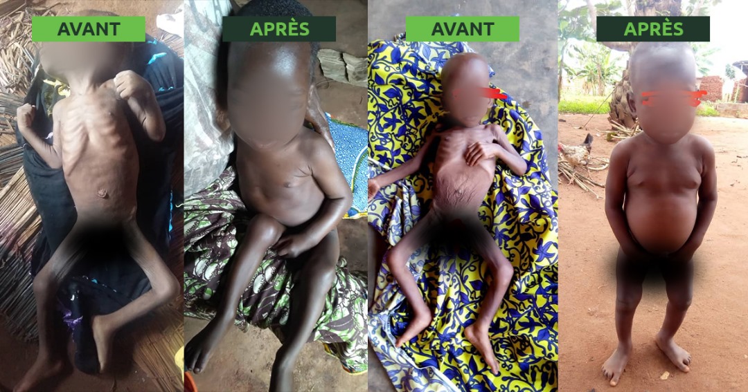 Une nouvelle vie pour Sègbégnon et Sunday après la malnutrition.
Dépistés et confirmés Malnutris Aiguë Sévère Avec Complication (MASAC), Sègbégnon (19 mois) et Sunday (24 mois) ont été pris en charge et récupérés avec succès. Une joie pour leurs parents.
bitly.ws/33dYF
