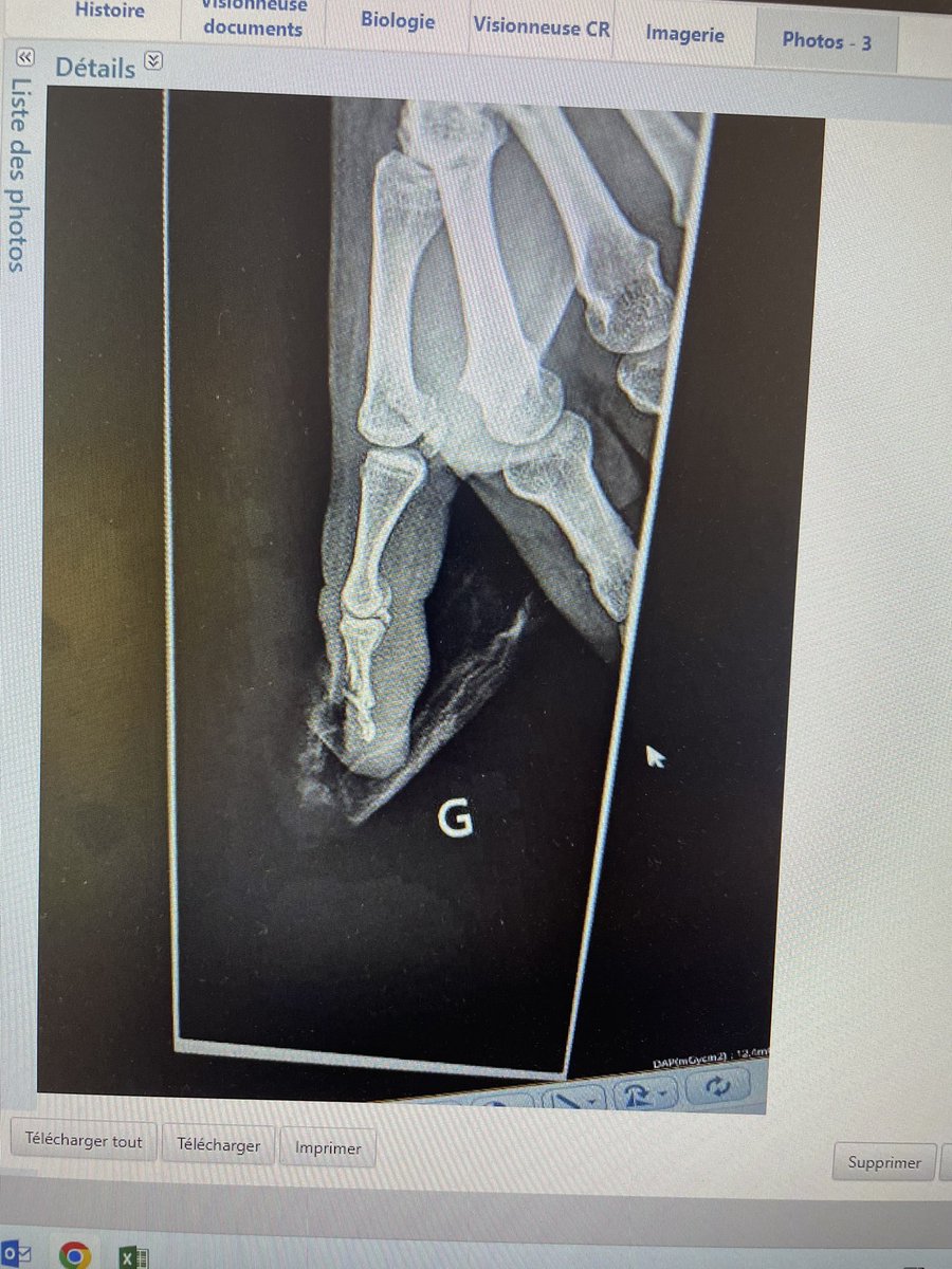 DrThomasHAMON's tweet image. #CoupDePouce  ou #CoupDuLapin ?