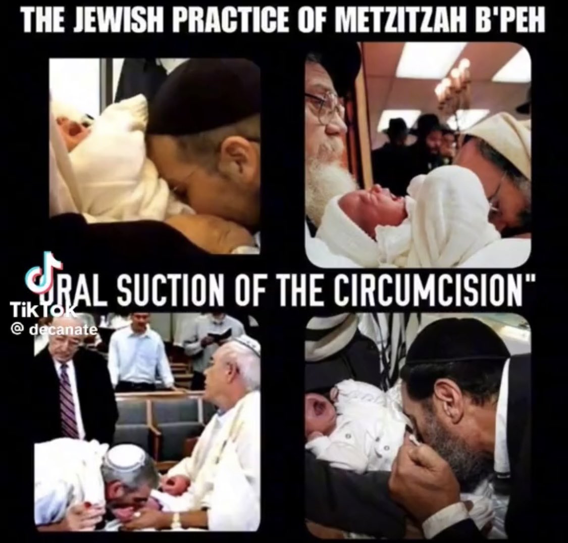 cetinlimonboy's tweet photo. Ağızdan Emmeli Sünnet Nedir ve Nereden Gelmektedir?

Papa Francis, sünnetten sonra yeni doğmuş bir bebeğin penisinden kanın ağız yoluyla emildiği bir Roma Katolik ve Ortodoks Yahudi geleneği olan 

Eski İbranice 'de ,Metzitzah B'Peh'e (MBP) işaret ediyor; "Kes ve em" olarak da bilinen uygulaması diye değiştirmişlerdir,

 Çok sayıda bebeğin genital herpes ve diğer cinsel yolla bulaşan hastalıklara yakalanmasıyla sonuçlandı. ..

Haham Neşterini hızla savurarak erkek bebeği sünnet ediyor, ardından eğilip İbranice dualarla doldururken penis'in kanını emiyor.

Ağızdan emmeli sünnet olarak bilinen Ortodoks Yahudi geleneği ..!
https://t.co/JxqQYMbqG4…
