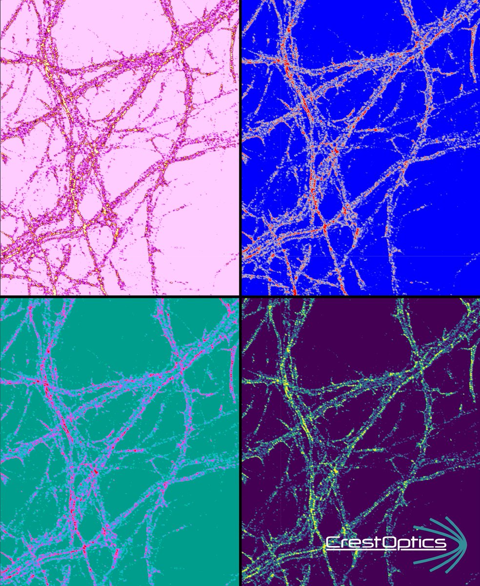CrestOptics's tweet photo. 🔬Image of the week #CrestOptics
🎨🧠Between #sfn23 and #cellbio2023 conferences, we marvel at the stunning blend of #science &amp; #art. Look at this #Warhol inspired neuronal cytoskeleton design where creativity meets knowledge #ScienceMeetsArt #FluorescenceFriday #BrightBrain https://t.co/nt7ZhqX2cr