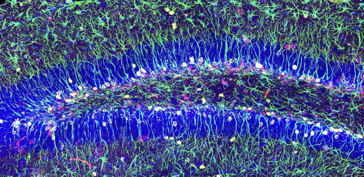 CSIC's tweet photo. Descubren el mecanismo que asegura la reserva de células madre para la generación neuronal en la edad adulta. El @IBV_CSIC comprueba que la autofagia, proceso que elimina componentes celulares dañados, controla que las células madre entren en reposo.
▶️https://t.co/FjB4GjImYL https://t.co/muL4Z2ckl5