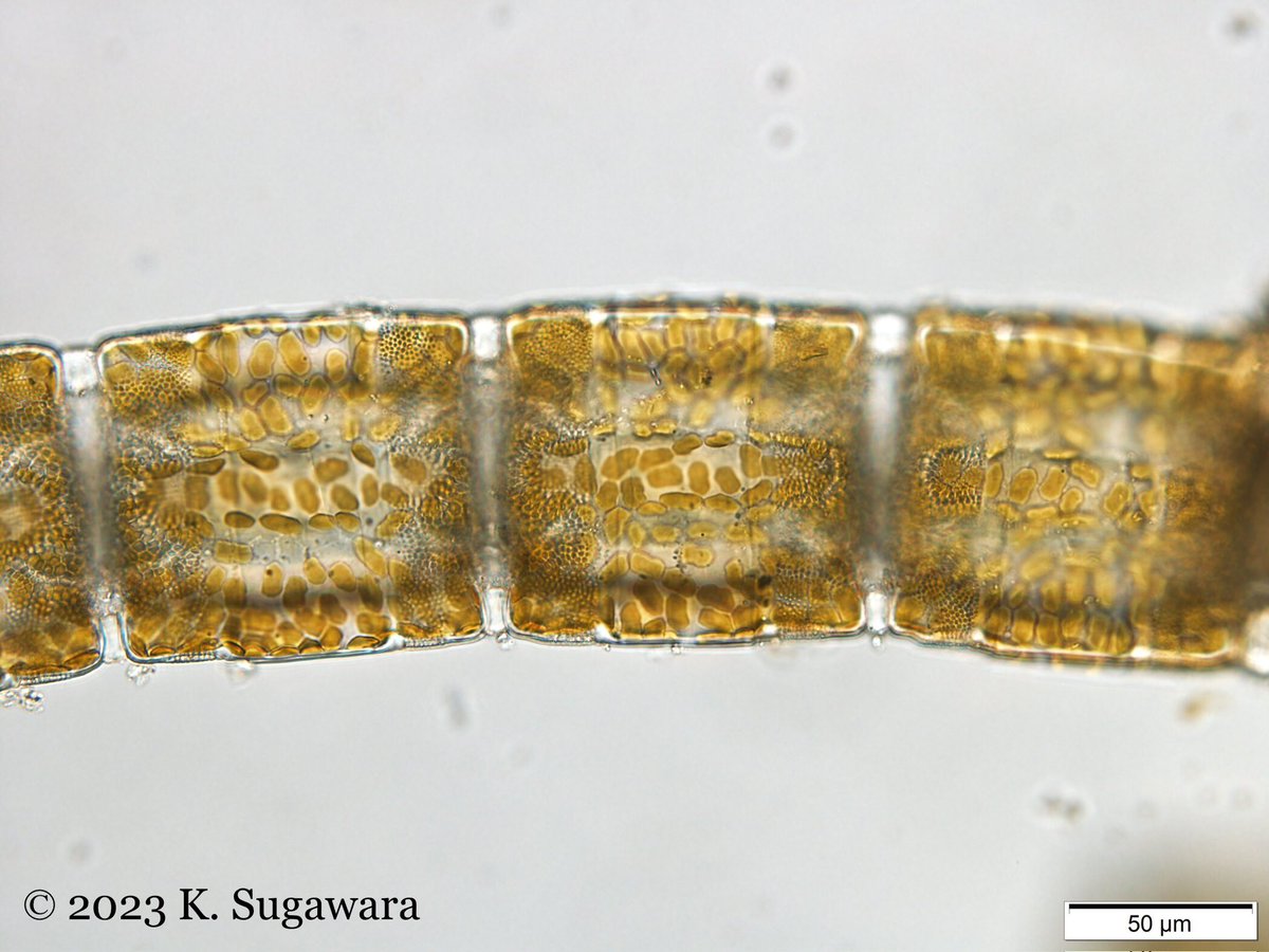 Three #diatom genera, #Melosira #Pleurosira #Hydrosera from Japanese brackish water

#珪藻 #藻類 #diatom #algae #Phycology