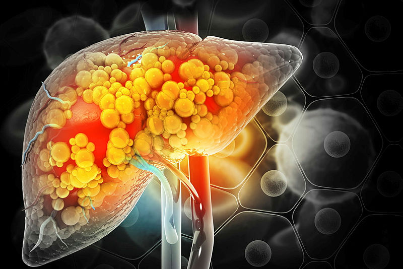 Communications Medicine (@commsmedicine) on Twitter photo 📢 CALL FOR PAPERS - We invite submissions to a collection on advances in #MASLD/#NAFLD, guest-edited by Drs. <a href="/AlinaAllenMD/">Alina Allen</a>, <a href="/OGovaere/">Olivier Govaere</a>,
<a href="/MonicaTincopa/">Mónica Tincopa MD MSc</a> & <a href="/Zarrinparlab/">Amir Zarrinpar</a>. Find out more & submit your clinical, translational & public health research: nature.com/collections/gg… 📢 CALL FOR PAPERS - We invite submissions to a collection on advances in #MASLD/#NAFLD, guest-edited by Drs. <a href="/AlinaAllenMD/">Alina Allen</a>, <a href="/OGovaere/">Olivier Govaere</a>,
<a href="/MonicaTincopa/">Mónica Tincopa MD MSc</a> & <a href="/Zarrinparlab/">Amir Zarrinpar</a>. Find out more & submit your clinical, translational & public health research: nature.com/collections/gg…