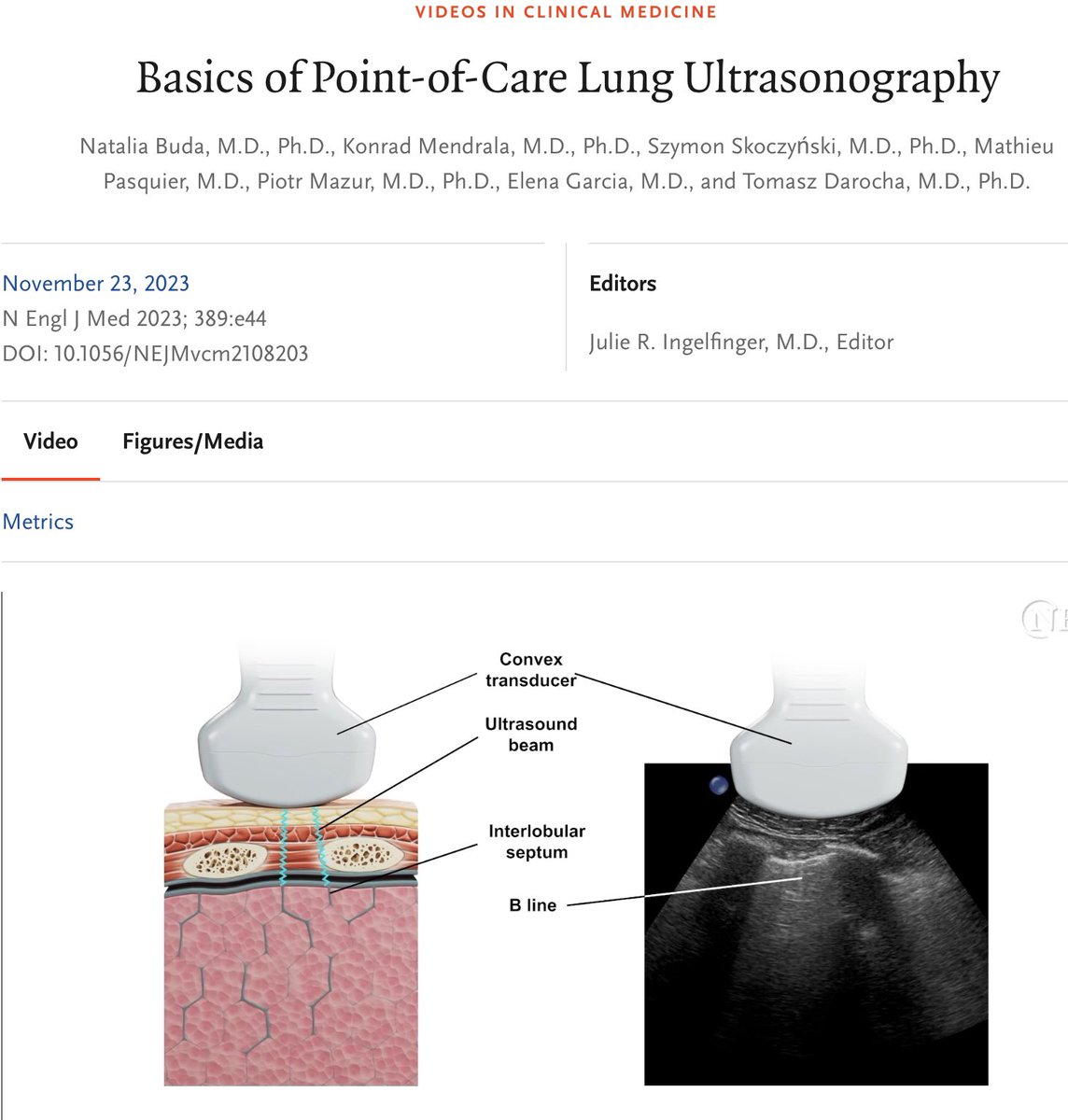 Fantástica por sencilla y útil la revisión práctica del Eco pulmonar en el NEJM ..imperdible nejm.org/doi/full/10.10…