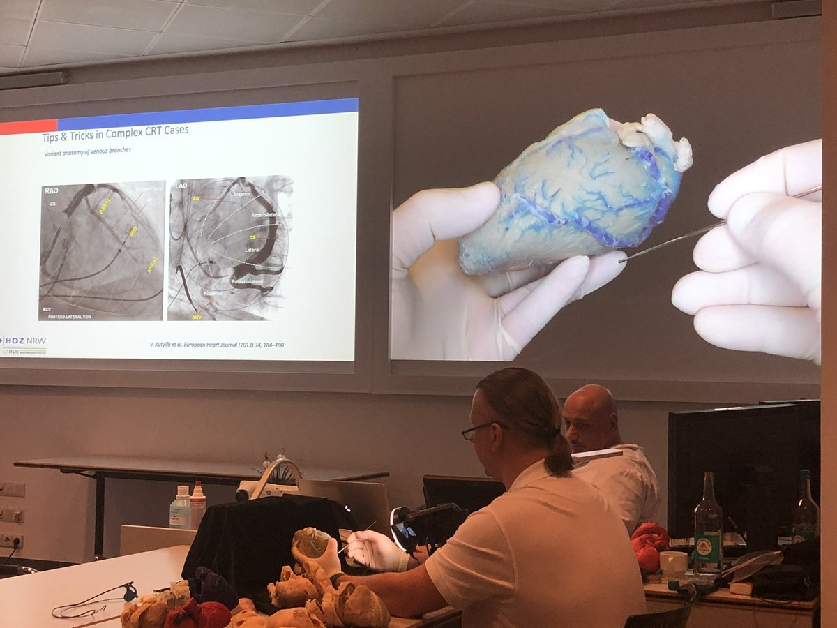 Phiso_de's tweet photo. First „Anatomy for EP“ course at @HdzNrw with @Cardioschool and @GuramImnadze . Real hands-on experience! So important…. @jacabreracardio @VRubesch @YoungDgk @AGEP_DGK https://t.co/Hd78ceqnND
