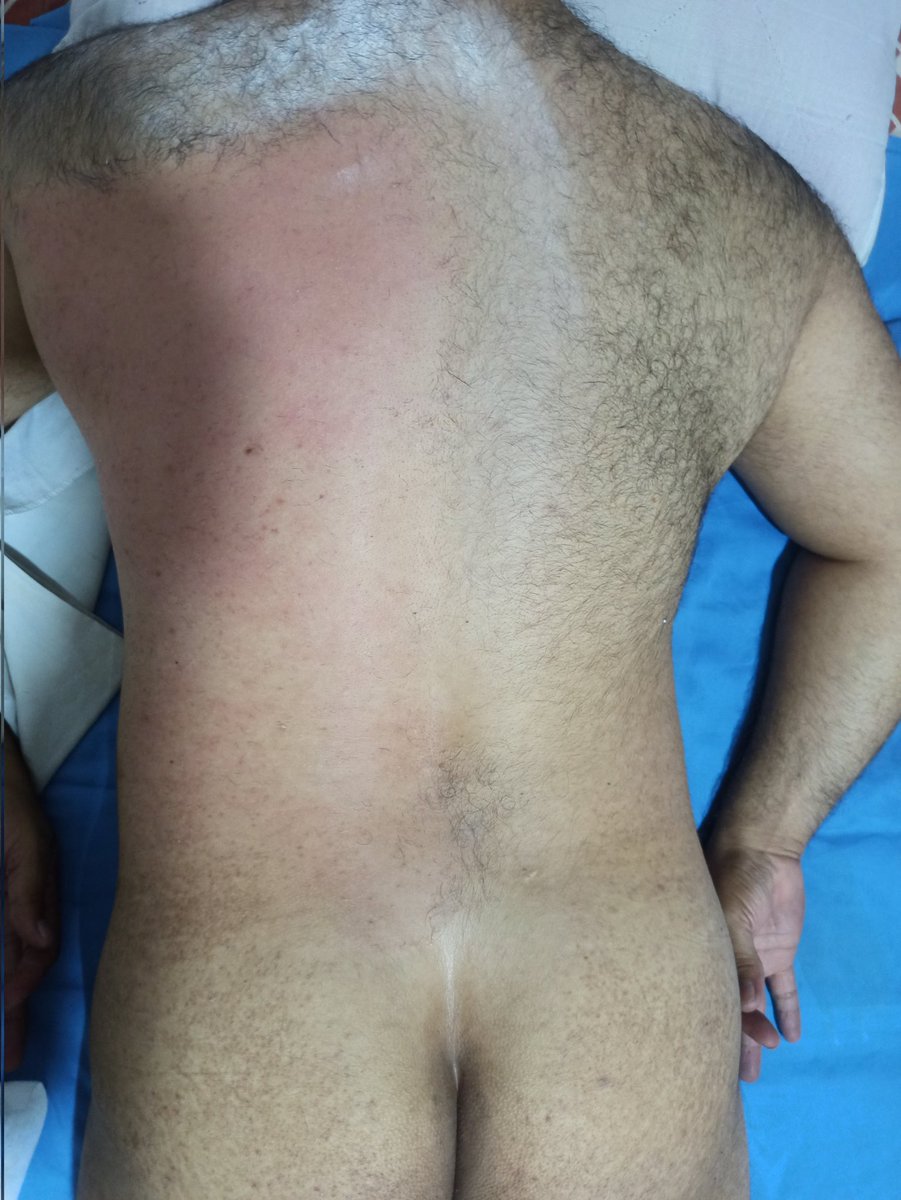 John_suckerass's tweet photo. Hola buen dia gaiteros hoy viernes servicio de depilacion con cera y masaje relajante . inf dm.
#masajescali
#eventosgaycali
#depialcionescali
#masajistascali https://t.co/5l9lVL0cUN