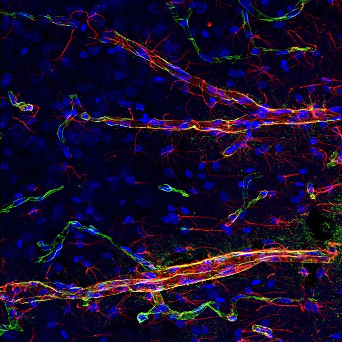 Astrocytes are star-shaped cells that can relay signals from nerve cells in the brain to blood vessels. 

@NeuroErinPhD investigates these cells in the lab and uses green fluorescent dye to stain the feet of the astrocytes! 💚 #ARUKImageOfTheWeek
