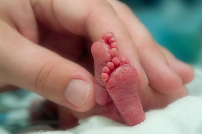 NICU_Musings's tweet photo. Survival rate of single unit in Japan at 22 weeks gestation = 82.8%
No patient required a tracheostomy or ventriculoperitoneal shunt
If we believe that could be our future too
https://t.co/2SQqgW34u6
#neoTwitter https://t.co/MWnDggEIRF