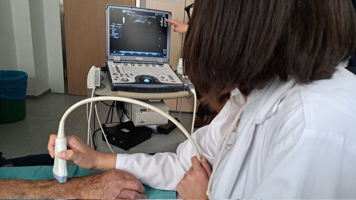 NefroCHUO's tweet photo. Día de valoración multidisciplinar nefróloga-enfermera del acceso vascular en paciente ERCA previo a entrada en hemodiálisis, fundamental para evitar sorpresas posteriores
@ElenaIglesiasL4 #hemodialisis #ERCA #econefro @SEDENenfermeria
Mejorando el #accesovascular 🩺 https://t.co/ZrsfbX5jKd