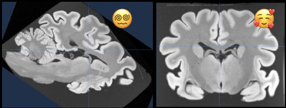 Do you have sometime brain MRIs with weird orientations? You can quickly reorient them online with our tool neuroanatomy.github.io/reorient ! (tutorial: joss.theoj.org/papers/10.2110…) @katjaQheuer