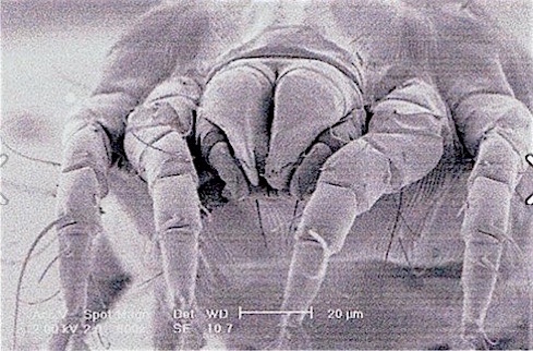 housedustmite's tweet photo. A HDM is a scavenger with parasitic-like functions designed to alarm, harm and activate the complex cascade of events that promote an allergic response to itself and others.  'Allergy' 2023,78:(5),1148-1168 @COPDdoc  @JacquiPolington @drlaurajane @GOLD_COPD https://t.co/zXeulBgUyu