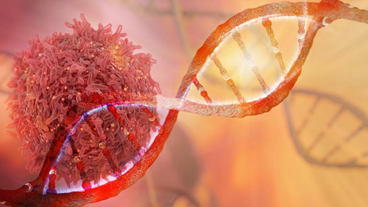 Rutgers Cancer Institute (@rutgerscancer) on Twitter photo ICYMI: <a href="/RutgersCancer/">Rutgers Cancer Institute</a>'s Dr. Matthew Deek <a href="/matthewdeek/">Matthew P Deek</a>, Dr. Jongmyung Kim <a href="/JKimMDPhD/">Jongmyung Kim, MD, PhD</a> & colleagues presented “Exploring Genetic Changes in Aggressive Pancreatic Cancer” at #ASTRO23
cinj.org/exploring-gene…
#radonc #pancreaticcancer #PancreaticCancerAwarenessMonth
<a href="/RWJMS/">Rutgers RWJMedSchool</a> <a href="/RWJBarnabas/">RWJBarnabas</a> ICYMI: <a href="/RutgersCancer/">Rutgers Cancer Institute</a>'s Dr. Matthew Deek <a href="/matthewdeek/">Matthew P Deek</a>, Dr. Jongmyung Kim <a href="/JKimMDPhD/">Jongmyung Kim, MD, PhD</a> & colleagues presented “Exploring Genetic Changes in Aggressive Pancreatic Cancer” at #ASTRO23
cinj.org/exploring-gene…
#radonc #pancreaticcancer #PancreaticCancerAwarenessMonth
<a href="/RWJMS/">Rutgers RWJMedSchool</a> <a href="/RWJBarnabas/">RWJBarnabas</a>