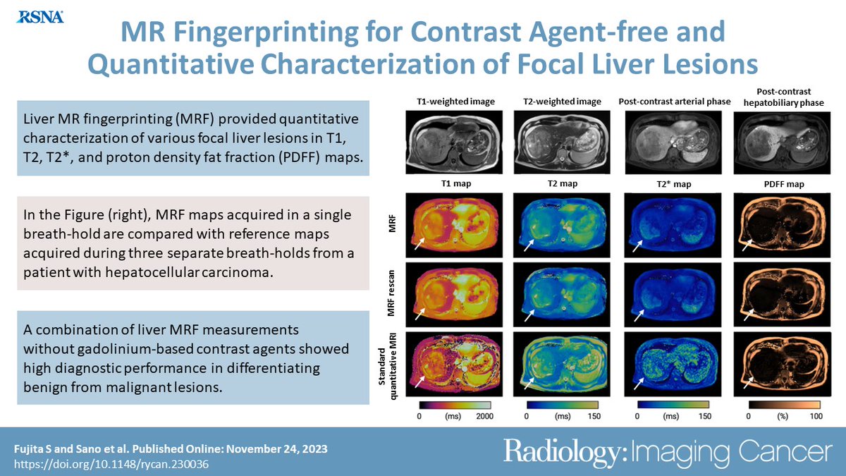A very special latest issue of Radiology: Imaging Cancer posted just before the RSNA Annual Meeting. Liver MR fingerprinting enabled the quantitative characterization of various focal liver lesions in a noncontrast single breath-hold acquisition. pubs.rsna.org/doi/10.1148/ry…