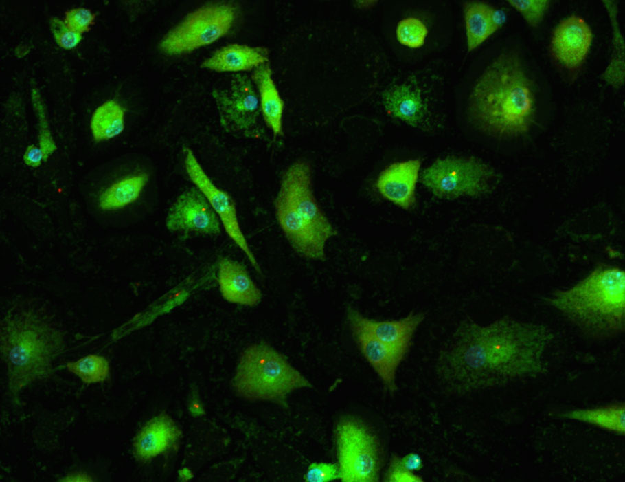 A study from <a href="/mgdoglio/">Giulia Doglio</a> reveals insights about the coupling of inflammatory and cell death pathways that drive severe autoinflammation caused by OTULIN deficiency in mice. <a href="/InflamResCen/">IRC - VIB/UGent</a> <a href="/ugent/">UGent</a>

📄: scim.ag/4WI