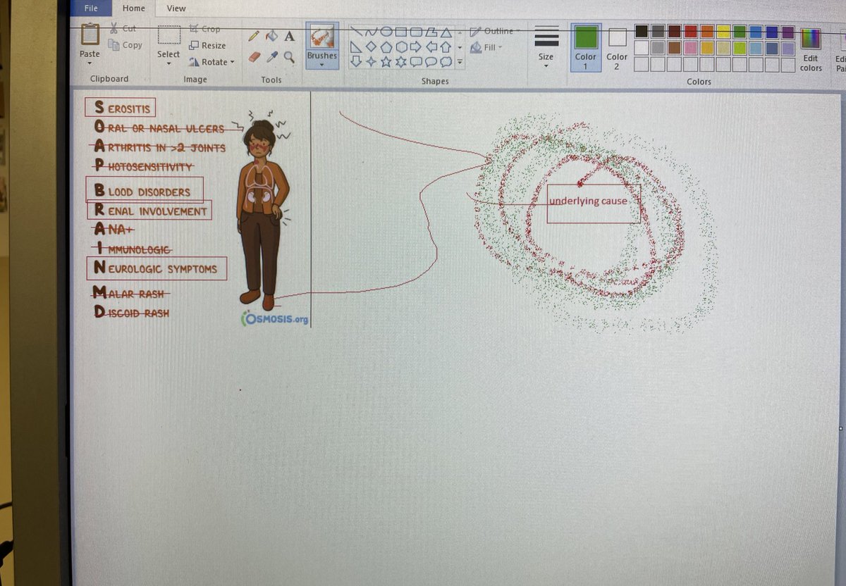 VipsMDMEd's tweet photo. #ChalkTalk on inpatient SLE, courtesy of @Microsoft paint.
#KickinItOldSkool https://t.co/FjfLRfrr5p
