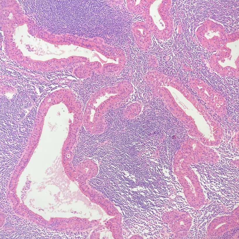 megothelioma tweet picture