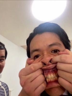 霜降り明星 粗品の変顔まだ面白い