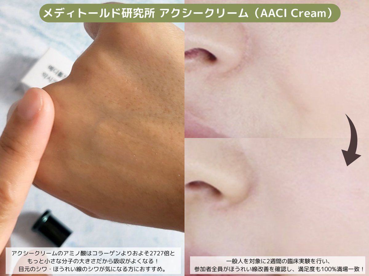 シワと同時に毛穴ケアをしたい方はアクシークリームがおすすめ