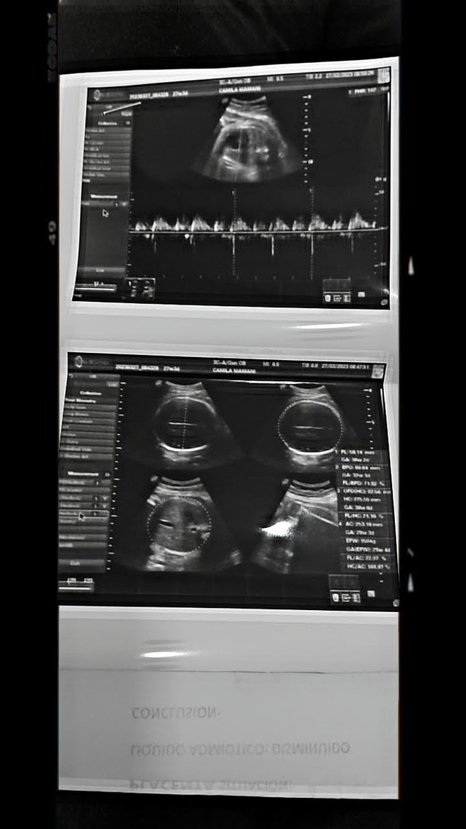 J O S ❤️‍🔥 😘 tweet media