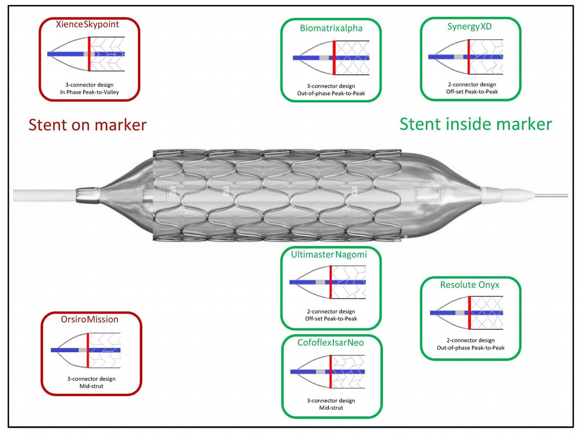 DrPatWJyg (@w_jyg) on Twitter photo Do you know the stent #edge is not always at the #marker !
<a href="/BotPci/">PCICaseBot</a> <a href="/PCRonline/">PCRonline 🫀</a> <a href="/APSIC6/">@APSIC</a> <a href="/GruentzigG/">Gruentzig's Ghost</a> <a href="/mirvatalasnag/">MIЯVΛƬ #IC</a> <a href="/mmamas1973/">Mamas A. Mamas</a> <a href="/dimitri_zappi/">Dimitri Zappi, M.D.</a> <a href="/mornei2011/">Neisser M</a> <a href="/jedicath/">jedicath աǟզǟʀ.ǟɦʍɛɖ</a> <a href="/ANazmiCalik/">A.Nazmi Calik</a> <a href="/LAzzaliniMD/">Lorenzo Azzalini</a> <a href="/sbrugaletta/">Salvatore Brugaletta</a> <a href="/KardiologieHH/">Erik Rafflenbeul</a> <a href="/MGtberg/">Matthias Götberg</a> <a href="/SVRaoMD/">Sunil V. Rao</a> <a href="/Tesslagra/">Rich_cathRT(CI)☢️</a> <a href="/uziyahya46/">A. Fauzi Yahya</a> <a href="/jl35wilsonMD/">Jeffrey Wilson, MD</a> Do you know the stent #edge is not always at the #marker !
<a href="/BotPci/">PCICaseBot</a> <a href="/PCRonline/">PCRonline 🫀</a> <a href="/APSIC6/">@APSIC</a> <a href="/GruentzigG/">Gruentzig's Ghost</a> <a href="/mirvatalasnag/">MIЯVΛƬ #IC</a> <a href="/mmamas1973/">Mamas A. Mamas</a> <a href="/dimitri_zappi/">Dimitri Zappi, M.D.</a> <a href="/mornei2011/">Neisser M</a> <a href="/jedicath/">jedicath աǟզǟʀ.ǟɦʍɛɖ</a> <a href="/ANazmiCalik/">A.Nazmi Calik</a> <a href="/LAzzaliniMD/">Lorenzo Azzalini</a> <a href="/sbrugaletta/">Salvatore Brugaletta</a> <a href="/KardiologieHH/">Erik Rafflenbeul</a> <a href="/MGtberg/">Matthias Götberg</a> <a href="/SVRaoMD/">Sunil V. Rao</a> <a href="/Tesslagra/">Rich_cathRT(CI)☢️</a> <a href="/uziyahya46/">A. Fauzi Yahya</a> <a href="/jl35wilsonMD/">Jeffrey Wilson, MD</a>