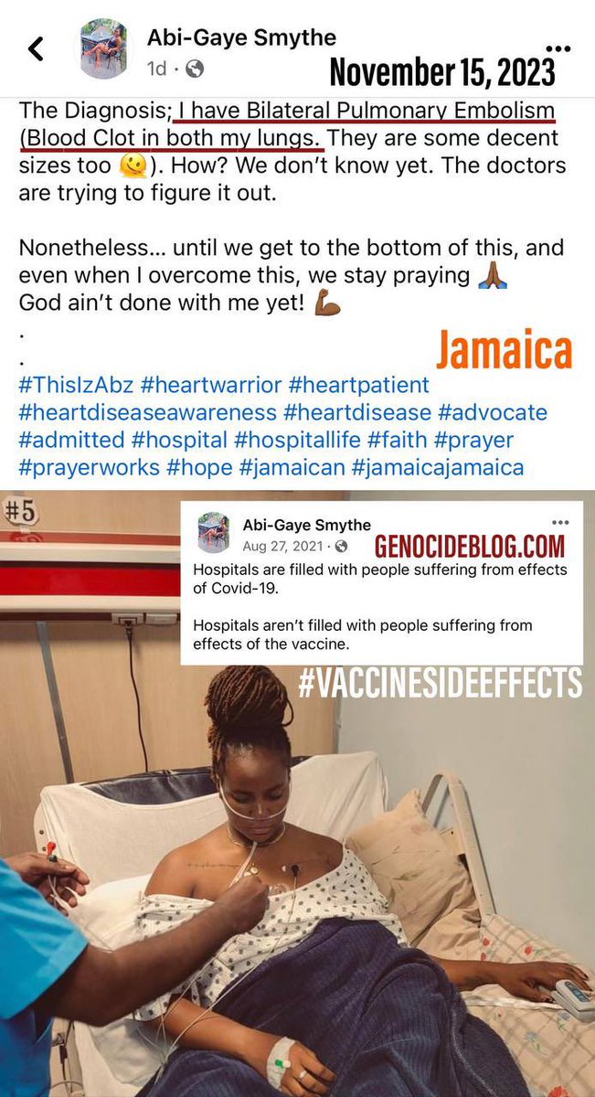 Fully vaccinated Jamaican Woman who mocked the unvaccinated was taken to the hospital to find that her lungs were riddled with blood clots earlier this month. She stated on social media before: “Hospitals are filled with people suffering from effects of Covid-19. Hospitals