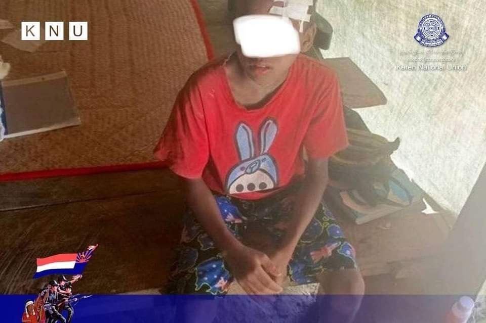 YeSoe91920267's tweet photo. A child of 10 and the two women of 60 and 27 were injured &amp; 7 homes were damaged of the shells for the terrorist military had fired the machinegun to Daungmo, Warpinsu &amp; Tawkyaungpauk villages in #Leido Township within 11:57a.m-12:07p.m on Nov 23.
#2023Nov25Coup
#WarCrimesOfJunta https://t.co/J0BCanuPZy