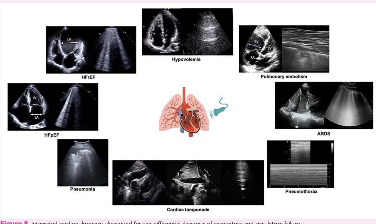 RECAT👩🏽‍⚕️🏥👨🏽‍⚕️🇲🇽🫀 tweet media