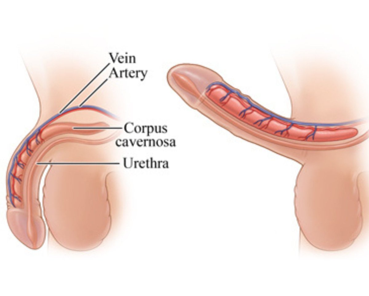 За эрчүүддээ энгийн зөвлөгөө оруулна аа. 
Зураг хараад тодорхой биз. 
1. Кегаль өдөрт 2-3 удаа хийх
2. Архины хэрэглээг багасгах
3. Порно үзэхгүй байх
4. Биеийн өөхний хэмжээг 25 аас доош хувьд барих
5. Цайр өдөрт 25мг- аар хэрэглэж байх
6. Тарвас идэж байх
7. Наранд алхах