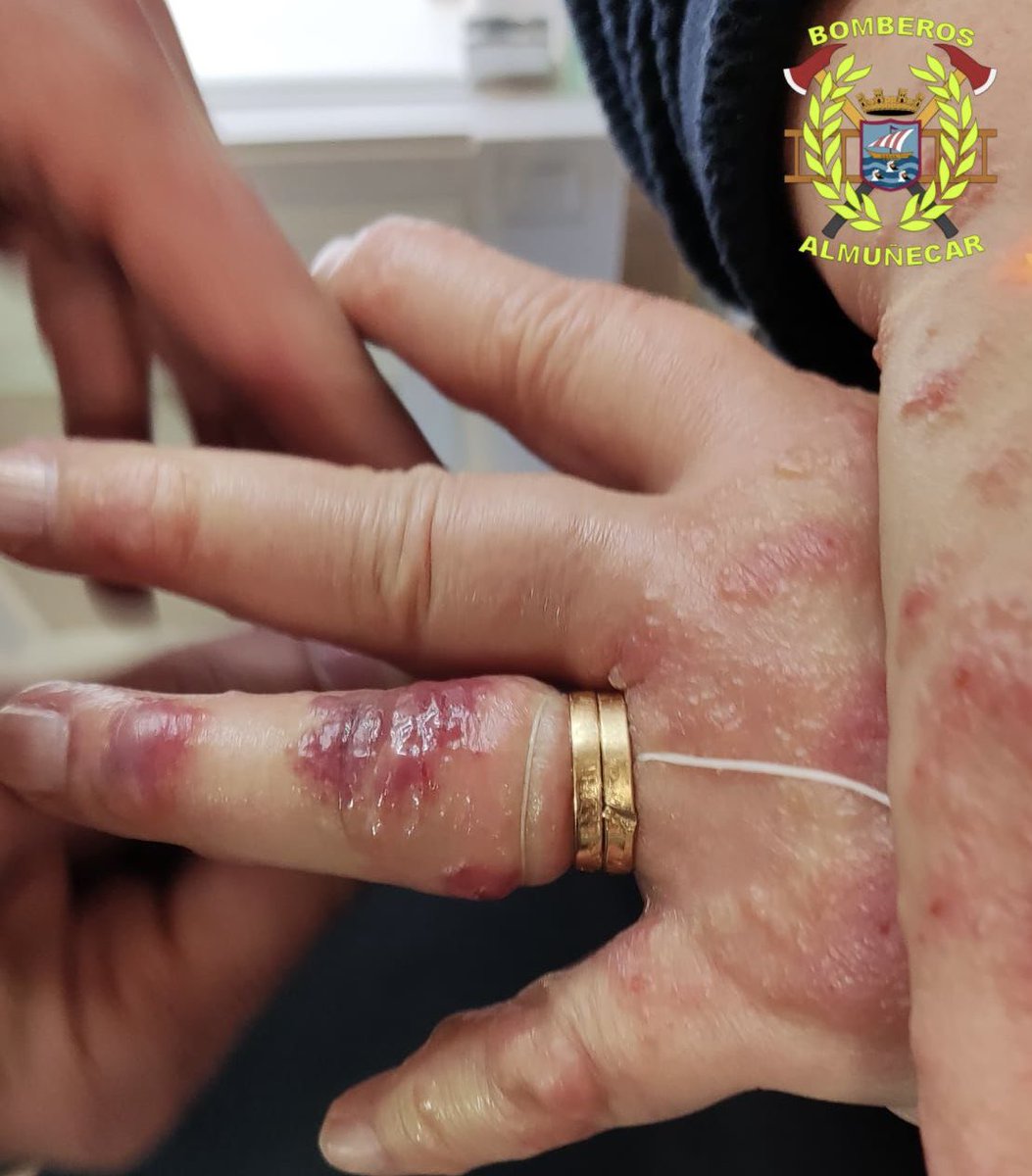 BOMBEROS ALMUÑÉCAR tweet media